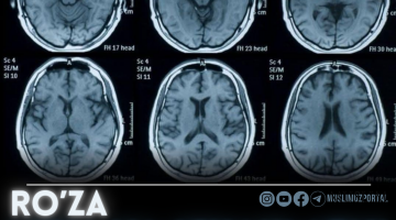 Рўза мия ва ичакларни қайта тиклайди
