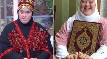 Daun sindromi kasali bilan tug'ilgan qiz qoriya bo'ldi