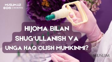 Ҳижома билан шуғулланиш ва унга ҳақ олиш мумкинми?